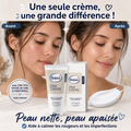 Balea Crème au Zinc – Anti-Rougeurs & Imperfections – 50 ml