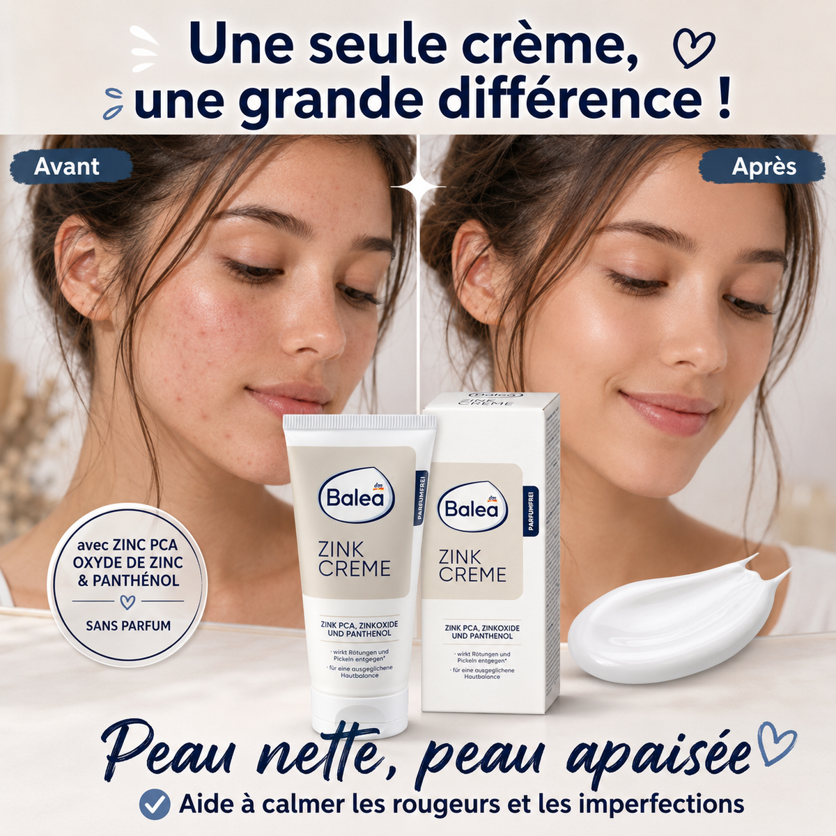 Balea Crème au Zinc – Anti-Rougeurs & Imperfections – 50 ml